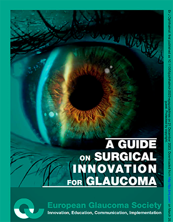 EGS: Guide til innovativ glaukomkirurgi